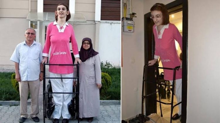 Türkiyəli Rumeysa Gelgi dünyanın ən uzun boylu qadını olaraq “Ginnesin rekordlar kitabı”na düşüb